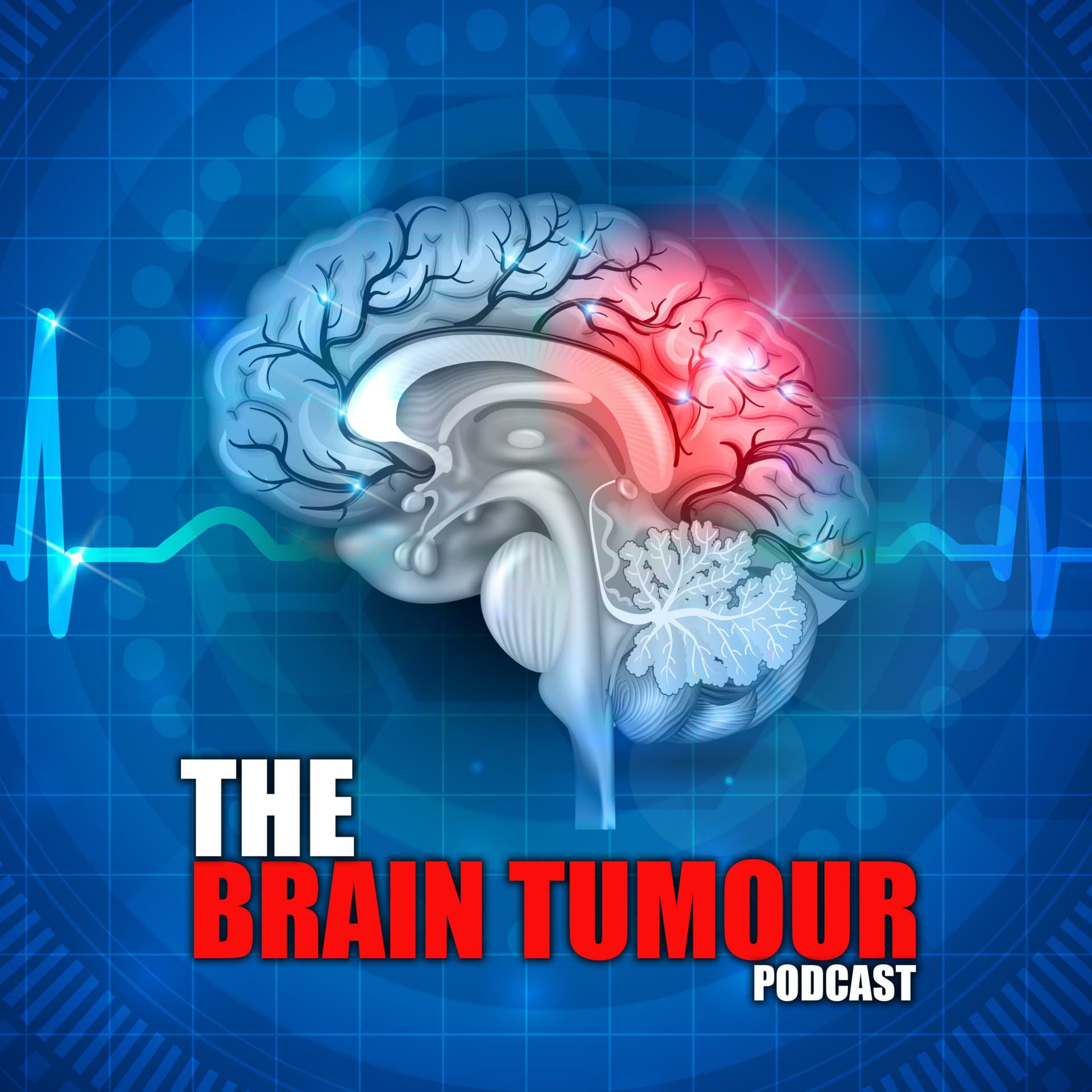 The Brain Tumour Podcast - Podcasts