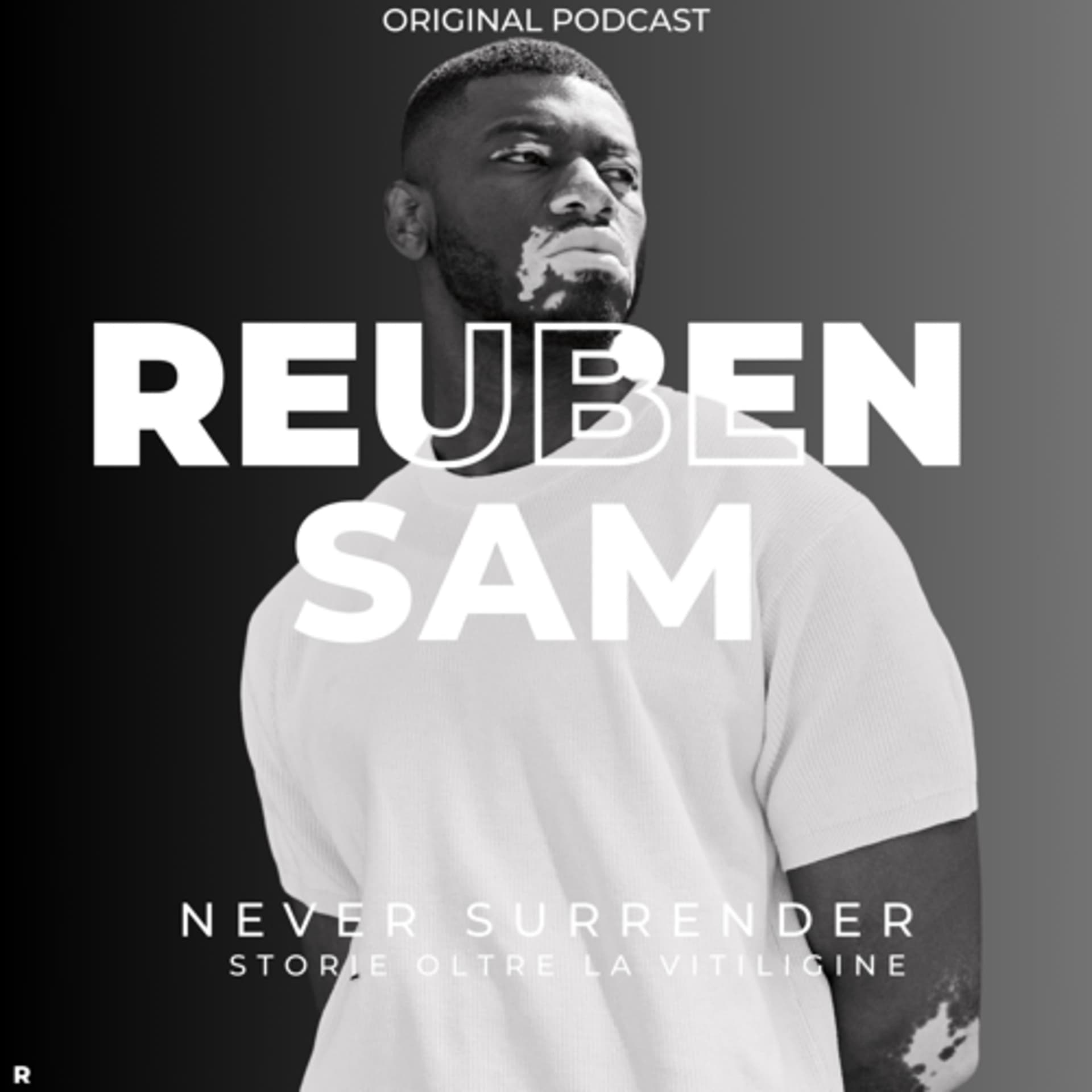 Never surrender - Storie oltre la vitiligine - Podcasts