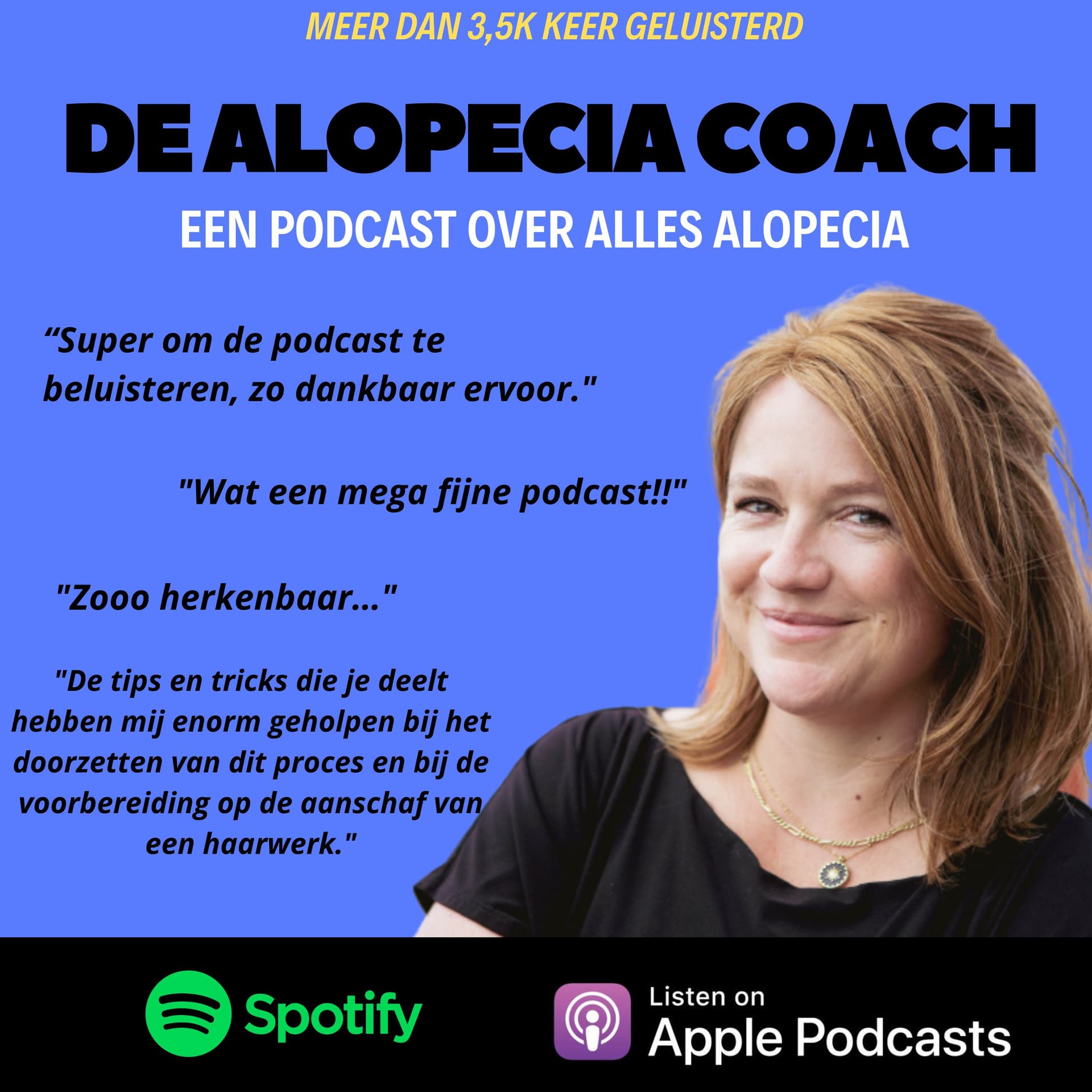 De Alopecia Coach Podcast | Haarverlies, haarwerken & zelfvertrouwen - Podcasts