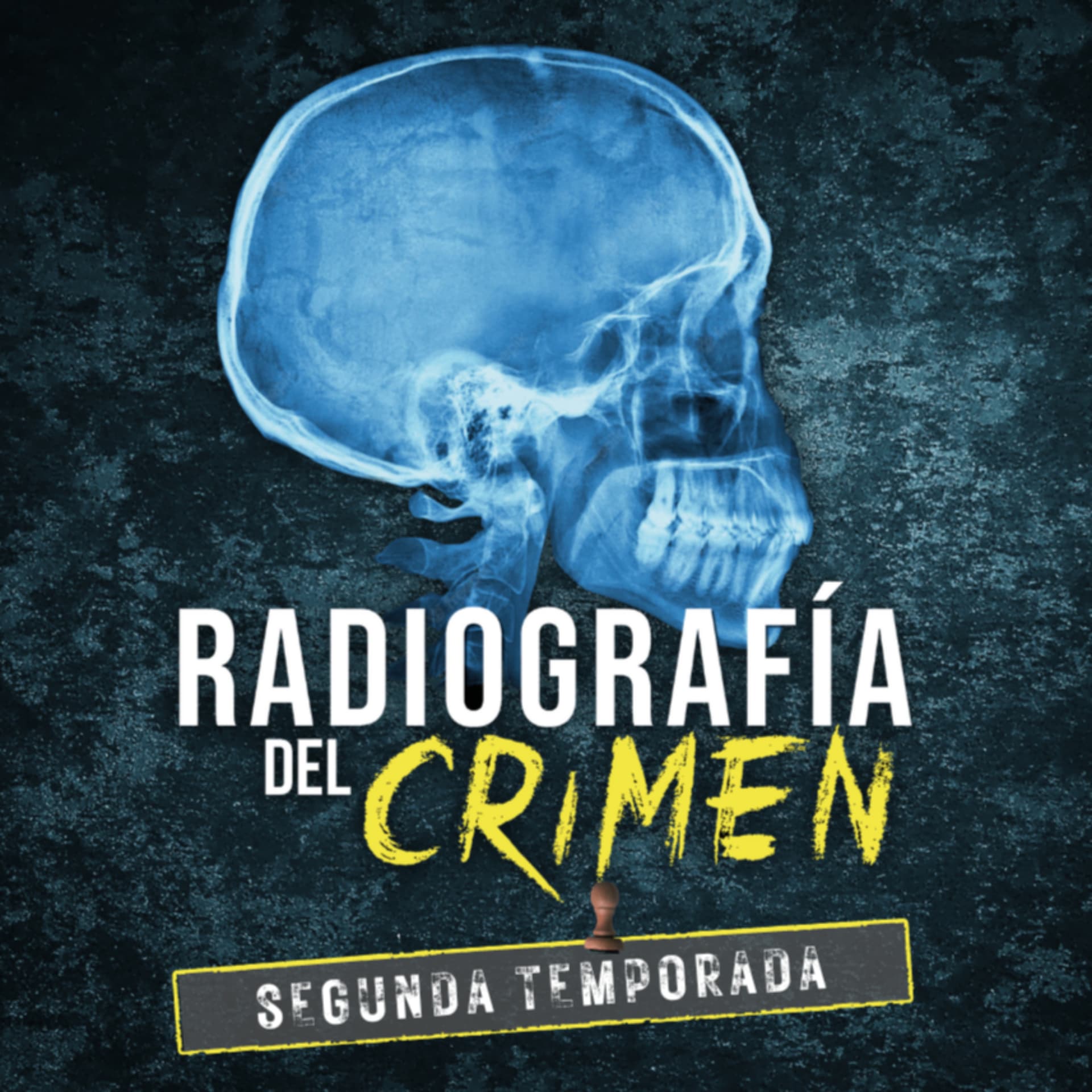 Radiografía del crimen - Podcasts