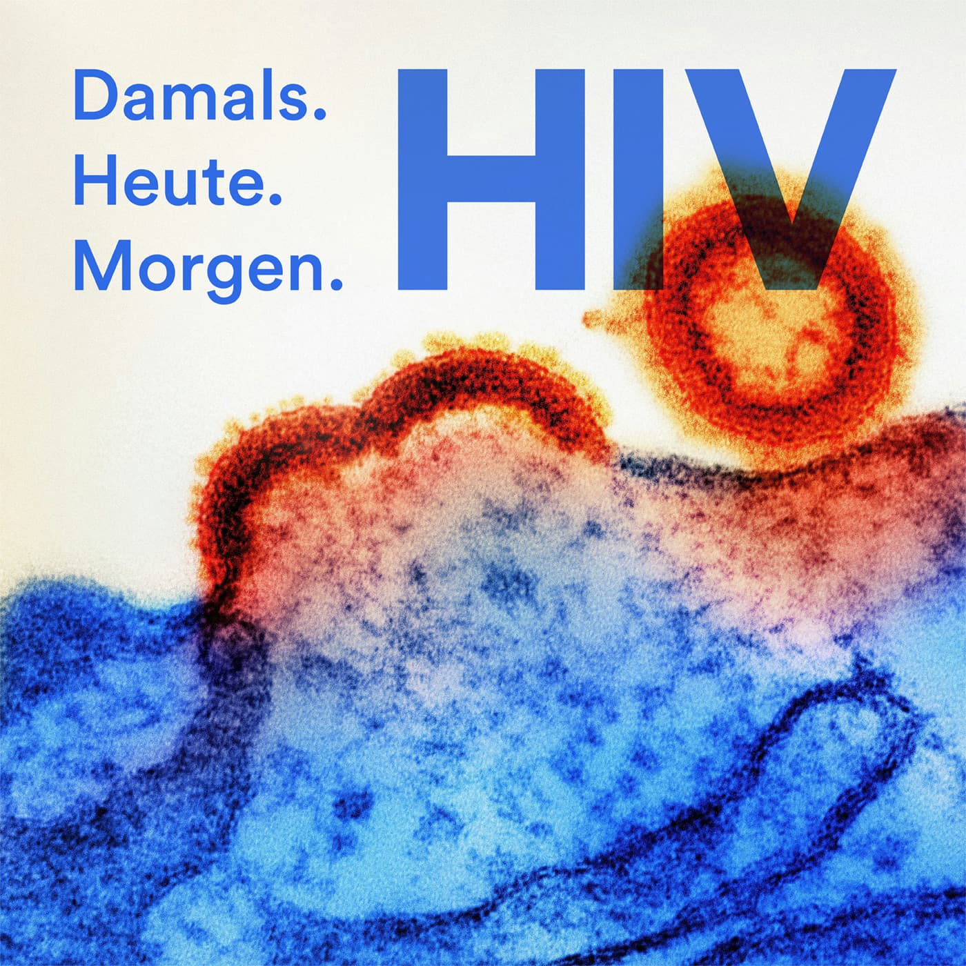 HIV - Damals. Heute. Morgen. - Podcasts