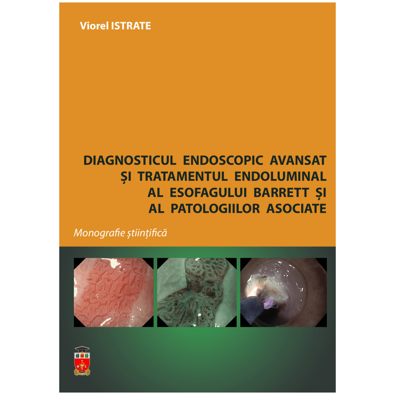 Diagnosticul endoscopic avansat și tratamentul endoluminal al esofagului Barrett și al patologiilor - Podcasts